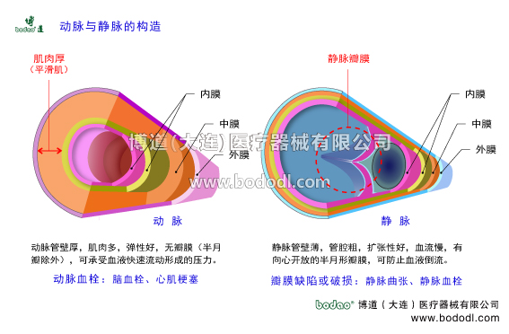 靜脈曲張的預(yù)防與治療