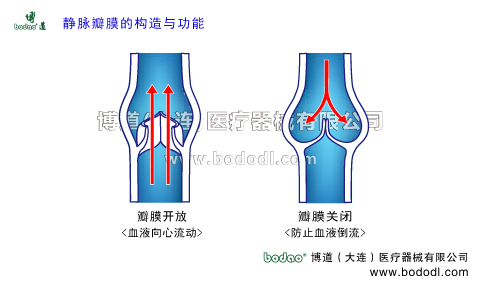 靜脈曲張的預防與治療