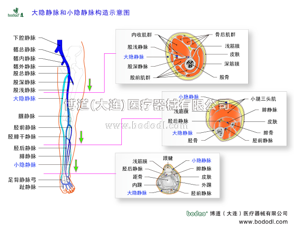 靜脈曲張的預防與治療