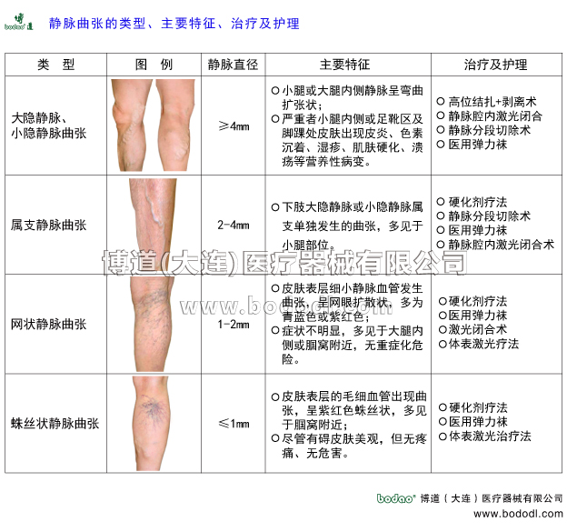 靜脈曲張的預防與治療