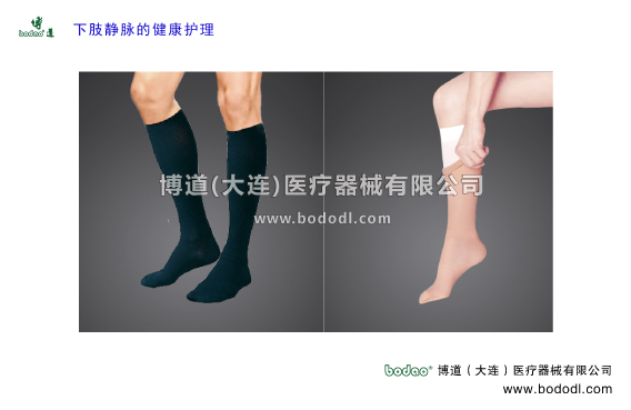 靜脈曲張的預防與治療