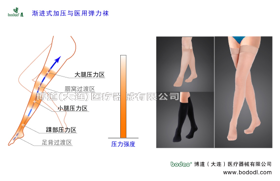 靜脈曲張的預防與治療