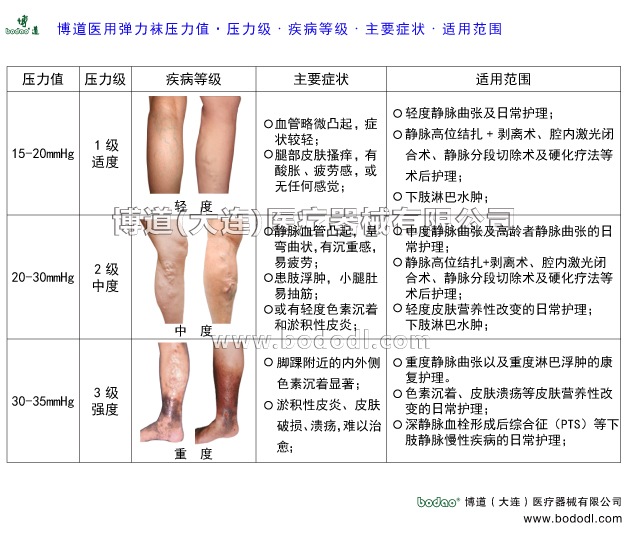 靜脈曲張的預防與治療