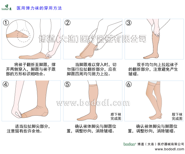 靜脈曲張的預防與治療