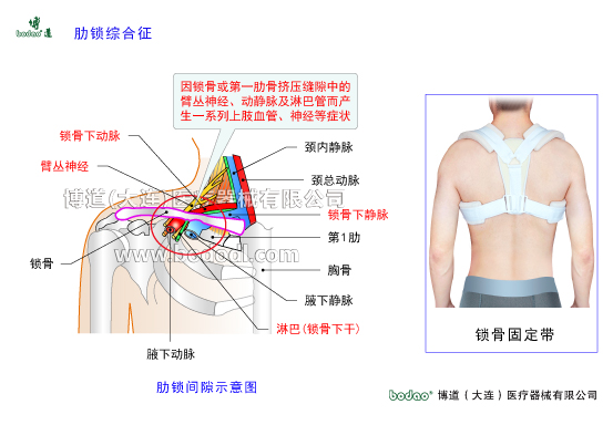 鎖骨的常見(jiàn)傷病與健康防護(hù)