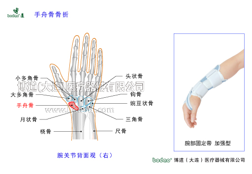腕關(guān)節(jié)的常見(jiàn)疾病與健康防護(hù)