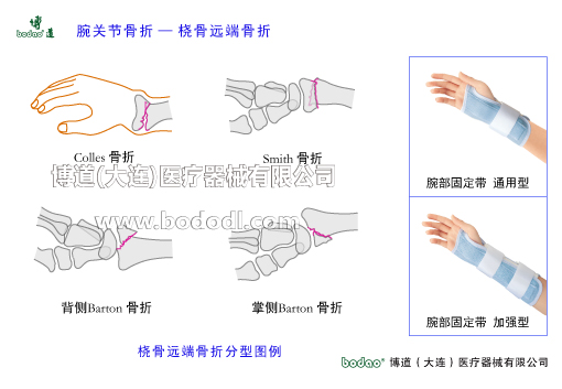 腕關(guān)節(jié)的常見(jiàn)疾病與健康防護(hù)