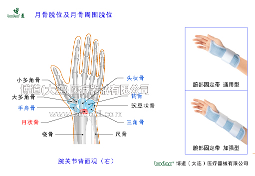 腕關(guān)節(jié)的常見(jiàn)疾病與健康防護(hù)