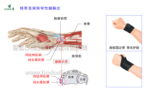 腕關(guān)節(jié)的常見(jiàn)疾病與健康防護(hù)