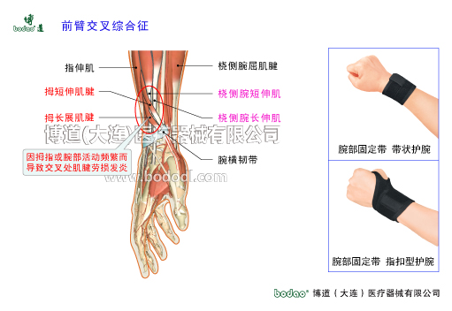 腕關(guān)節(jié)的常見(jiàn)疾病與健康防護(hù)