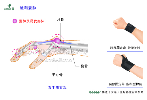 腕關(guān)節(jié)的常見(jiàn)疾病與健康防護(hù)