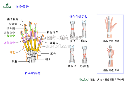 手關(guān)節(jié)常見(jiàn)傷病與健康防護(hù)