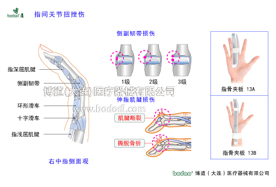 手關(guān)節(jié)常見(jiàn)傷病與健康防護(hù)