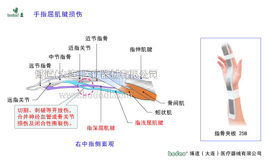 手關(guān)節(jié)常見(jiàn)傷病與健康防護(hù)