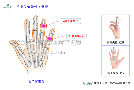 手關(guān)節(jié)常見(jiàn)傷病與健康防護(hù)