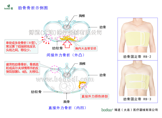 胸肋部常見(jiàn)疾病與健康護(hù)理