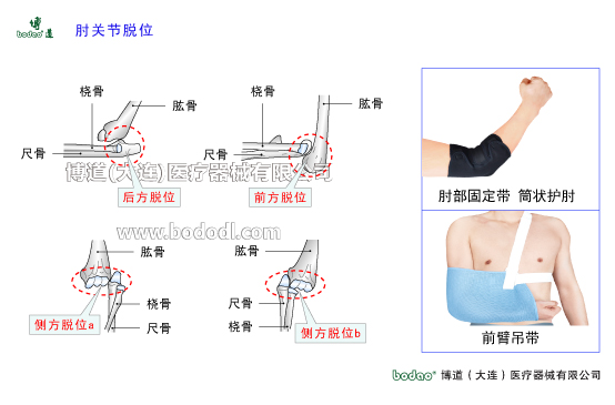 肘關(guān)節(jié)構(gòu)造及其常見傷病