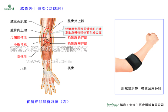 肘關(guān)節(jié)構(gòu)造及其常見傷病