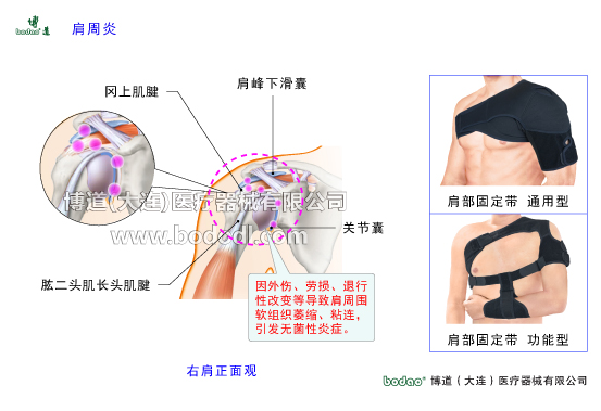 肩關(guān)節(jié)的常見疾病與健康防護(hù)