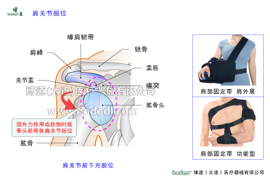 肩關(guān)節(jié)的常見疾病與健康防護(hù)