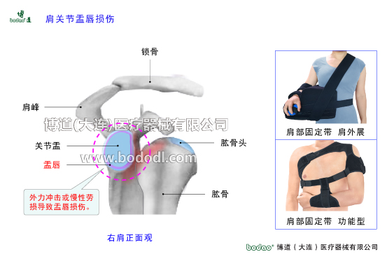 肩關(guān)節(jié)的常見疾病與健康防護(hù)