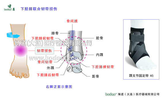 踝關(guān)節(jié)的構(gòu)造與常見傷病
