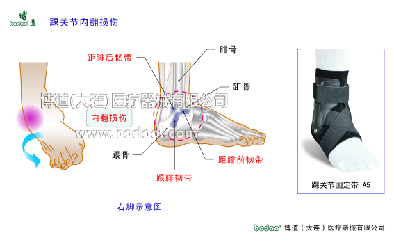 踝關(guān)節(jié)的構(gòu)造與常見傷病