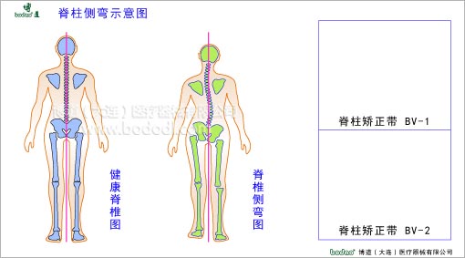 脊椎部疾病與健康護(hù)理