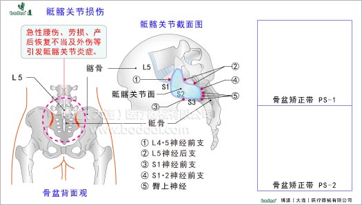 骨盆疾病與健康護(hù)理