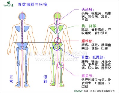 骨盆疾病與健康護(hù)理