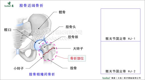 髖關(guān)節(jié)疾病與健康護(hù)理