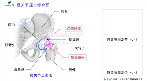 髖關(guān)節(jié)疾病與健康護(hù)理