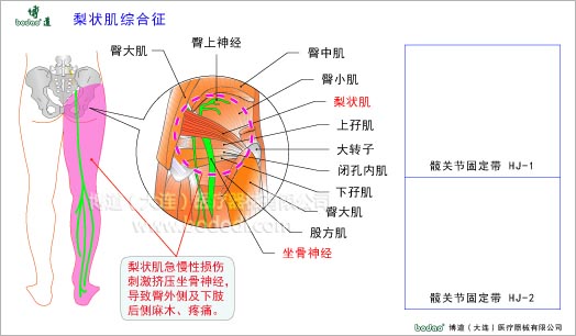 髖關(guān)節(jié)疾病與健康護(hù)理