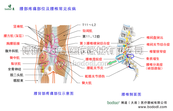 腰椎部常見疾病腰背部疼痛部位腰椎部主要病癥腰椎解剖構(gòu)造腰大肌腰方肌豎脊肌臀大肌臀中肌梨狀肌腹外斜肌背闊肌腰背部主要肌肉第三腰椎橫突綜合征背闊肌胸腰筋膜閃腰扭腰椎固定帶腰部固定帶醫(yī)用護腰肌勞損腰椎骨質(zhì)增生腰背肌筋膜炎腰椎間盤突出胸腰椎壓縮性骨折腰椎椎管狹窄腰椎小關(guān)節(jié)紊亂腰椎滑脫分離癥腰椎峽部裂腰骶關(guān)節(jié)勞損骶髂關(guān)節(jié)炎腰椎結(jié)核馬尾神經(jīng)綜合癥梨狀肌綜合征腰椎固定支具腰疼帶腰椎矯正固定牽引器腰椎病的預(yù)防與治療