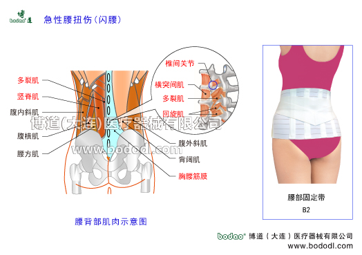 閃腰扭腰急性腰痛腰背筋膜損傷的主要癥狀與康復(fù)治療博道腰部固定帶醫(yī)用護腰急性腰扭傷易發(fā)部位，可分為豎脊肌損傷、多裂肌損傷、髂腰肌扭傷，棘上韌帶損傷，棘間韌帶損傷，胸腰深筋膜淺筋膜損傷，關(guān)節(jié)突關(guān)節(jié)損傷腰椎小關(guān)節(jié)損傷，腰骶關(guān)節(jié)損傷等。腰背部肌肉拉傷腰背部肌肉構(gòu)造腰大肌腰方肌豎脊肌多裂肌橫突間肌回旋肌腹外斜肌腹內(nèi)斜肌腹橫肌背闊肌胸腰筋膜腰椎間盤破裂腰椎骨裂骨折腰椎椎管狹窄腰椎小關(guān)節(jié)紊亂腰椎滑脫分離癥腰椎峽部