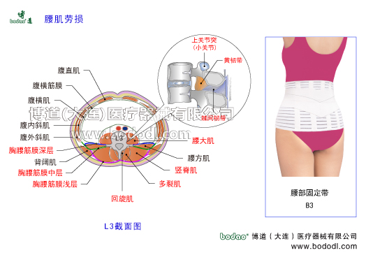 腰肌勞損慢性腰痛腰背肌筋膜炎功能性腰痛腰部軟組織損傷慢性腰痛的主要癥狀與治療博道腰部固定帶日本透氣性醫(yī)用護腰骶部軟組織慢性損傷豎脊肌腰大肌多裂肌腰背筋膜深層中層淺層腰扭傷腰椎部肌肉結(jié)構(gòu)解剖腰方肌豎脊肌橫突間肌回旋肌腹外斜肌腹內(nèi)斜肌腹橫肌背闊肌胸腰筋膜的功能腰椎骨質(zhì)增生腰椎間盤突出腰椎壓縮性骨折腰椎小關(guān)節(jié)紊亂腰骶關(guān)節(jié)勞損骶髂關(guān)節(jié)炎腰椎固定帶護腰帶腰圍腰托腰椎固定矯正牽引支具腰椎固定支具腰痛帶博道護腰透