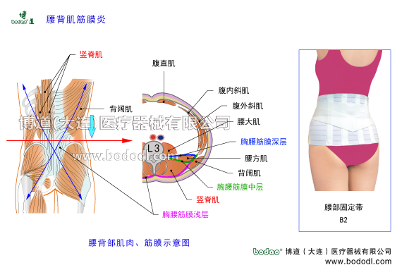 腰背肌筋膜炎的發(fā)病原因及癥狀，腰背肌筋膜炎的保守治療與手術(shù)治療。腰背肌筋膜炎的日常防護與治療方法。腰背肌筋膜又稱胸腰筋膜，由縱行的結(jié)締組織纖維編織而成，分淺層筋膜、中層筋膜和深層筋膜。博道腰部固定帶透氣性醫(yī)用護腰的功能與防護作用。腰背肌筋膜與肌肉的構(gòu)造，胸腰筋膜的構(gòu)造及功能與作用。第三腰椎截面圖和解剖構(gòu)造圖，腰背部神淺層肌肉構(gòu)造。閃腰扭腰等急性腰痛與慢性腰肌勞損，腰椎小關(guān)節(jié)紊亂椎間盤突出骨質(zhì)增生腰椎