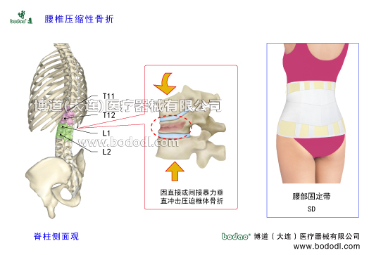 胸腰椎壓縮性骨折的發(fā)生原因、癥狀及治療。胸腰段壓縮性骨折的主要原因一是因間接暴力致傷及老年人骨質(zhì)疏松或肌肉瞬間強力收縮等所造成的創(chuàng)傷，二是因直接暴力致傷。另外，骨結(jié)核、骨腫瘤等疾病也可導致椎骨壓縮性骨折。博道腰椎固定帶透氣性醫(yī)用護腰的功能與防護作用。胸腰椎壓縮性骨折的易發(fā)部位及保守治療和手術(shù)治療方法。為什么胸腰段容易發(fā)生椎體壓縮性骨折。日本透氣性護腰帶腰椎部骨折支具，博道透氣性醫(yī)用腰部固定帶
