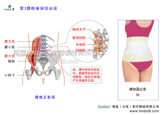 第三腰椎橫突綜合癥及主要癥狀L3橫突綜合征的預(yù)防與治療博道醫(yī)用護腰部固定帶第3腰椎位于腰椎的中心樞紐第3腰椎的特點是橫突最長附近有血管神經(jīng)束經(jīng)過是腰方肌腰大肌豎脊肌橫突棘肌橫突間肌骶棘肌腰小肌髂肌椎間關(guān)節(jié)多裂肌回旋肌橫突棘肌腰背筋膜的起點或止點，第3腰椎橫突受外力牽拉附著肌肉筋膜撕裂出血瘢痕粘連筋膜增厚攣縮致使血管神經(jīng)束受摩擦刺激和壓迫而出現(xiàn)腰臀部局部性疼痛卡壓綜合癥腰椎壓縮性骨折腰肌筋膜勞損慢性腰