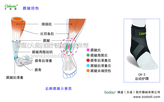 踝關(guān)節(jié)的運(yùn)動(dòng)損傷與防護(hù)