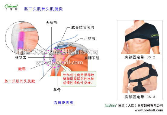 肩關(guān)節(jié)的運動損傷與防護(hù)