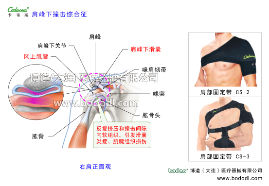 肩關(guān)節(jié)的運動損傷與防護(hù)