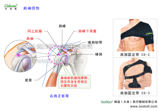肩關(guān)節(jié)的運動損傷與防護(hù)