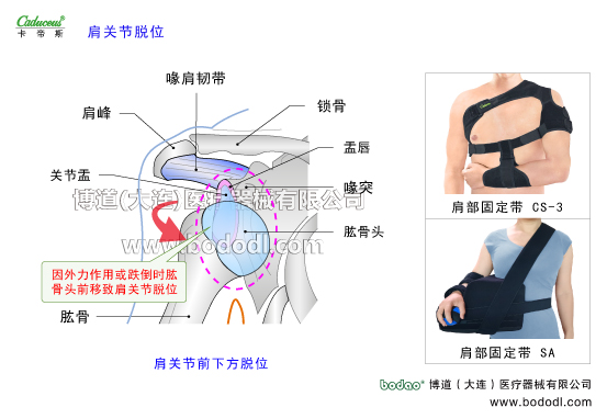 肩關(guān)節(jié)的運動損傷與防護(hù)