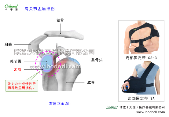 肩關(guān)節(jié)的運動損傷與防護(hù)