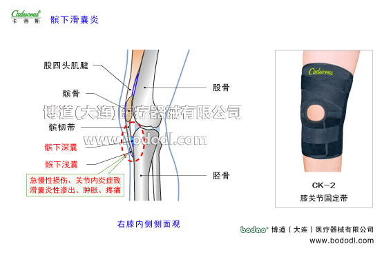 膝關(guān)節(jié)的運動損傷與防護(hù)