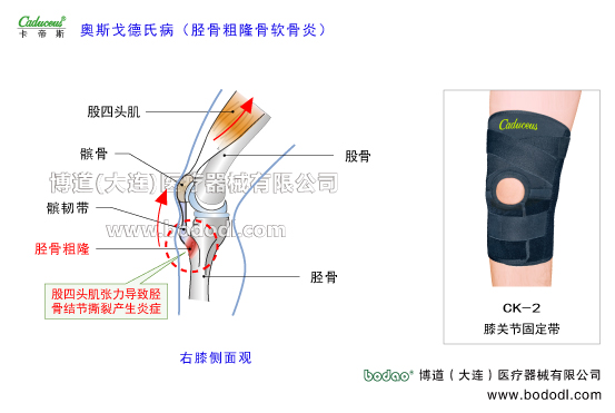 膝關(guān)節(jié)的運動損傷與防護(hù)