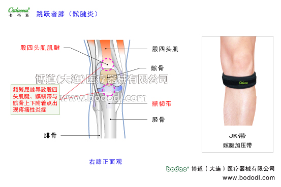膝關(guān)節(jié)的運動損傷與防護(hù)