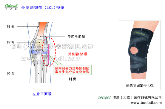 膝關(guān)節(jié)的運動損傷與防護(hù)