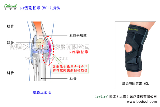 膝關(guān)節(jié)的運動損傷與防護(hù)